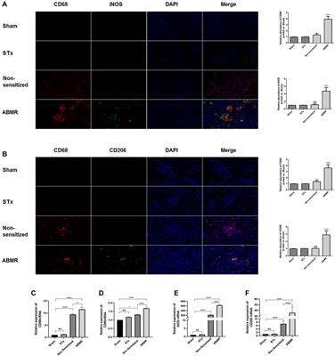 Iguratimod Attenuates Macrophage Polarization and Antibody-Mediated Rejection After Renal Transplant by Regulating KLF4